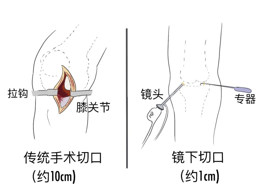 带你一起认识关节镜