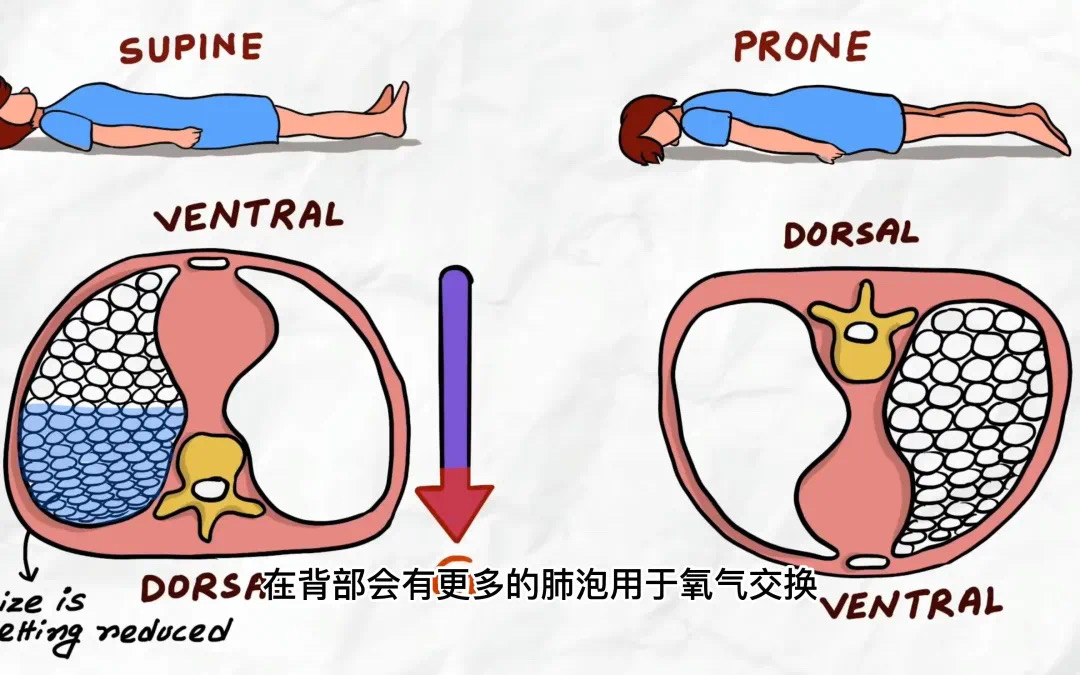 换个姿势睡觉，竟然可以救命