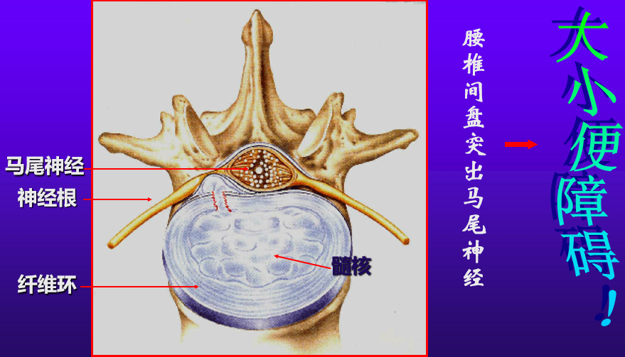 骶神经示意图图片