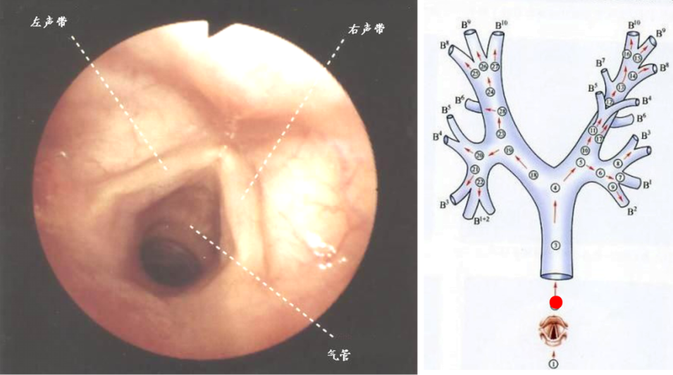 纤维支气管镜解剖图谱图片