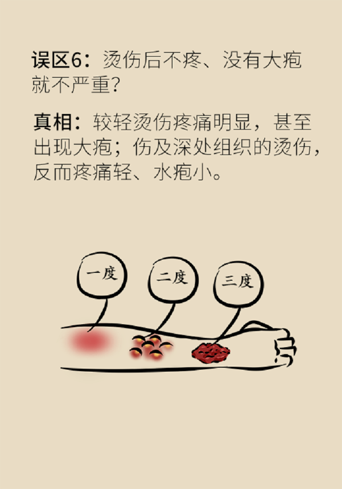烧烫伤后不痛,不一定表示烫得不重.伤口不痛,反而表示伤势比较严重.