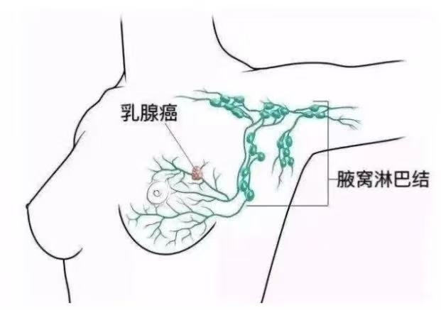 6a84c00624217e41d1fe64534606f7a